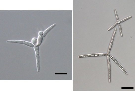 Tetracladium fraxineum sp. nov(좌)와 Lemonniera fraxinea sp. nov(우)의 포자 모양.