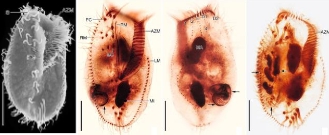 신종 섬모충(거대형 세포). 평균 220㎛ x 110㎛.